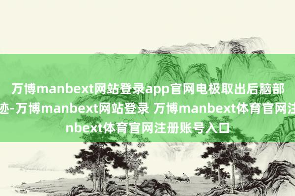 万博manbext网站登录app官网电极取出后脑部仅留微细印迹-万博manbext网站登录 万博manbext体育官网注册账号入口